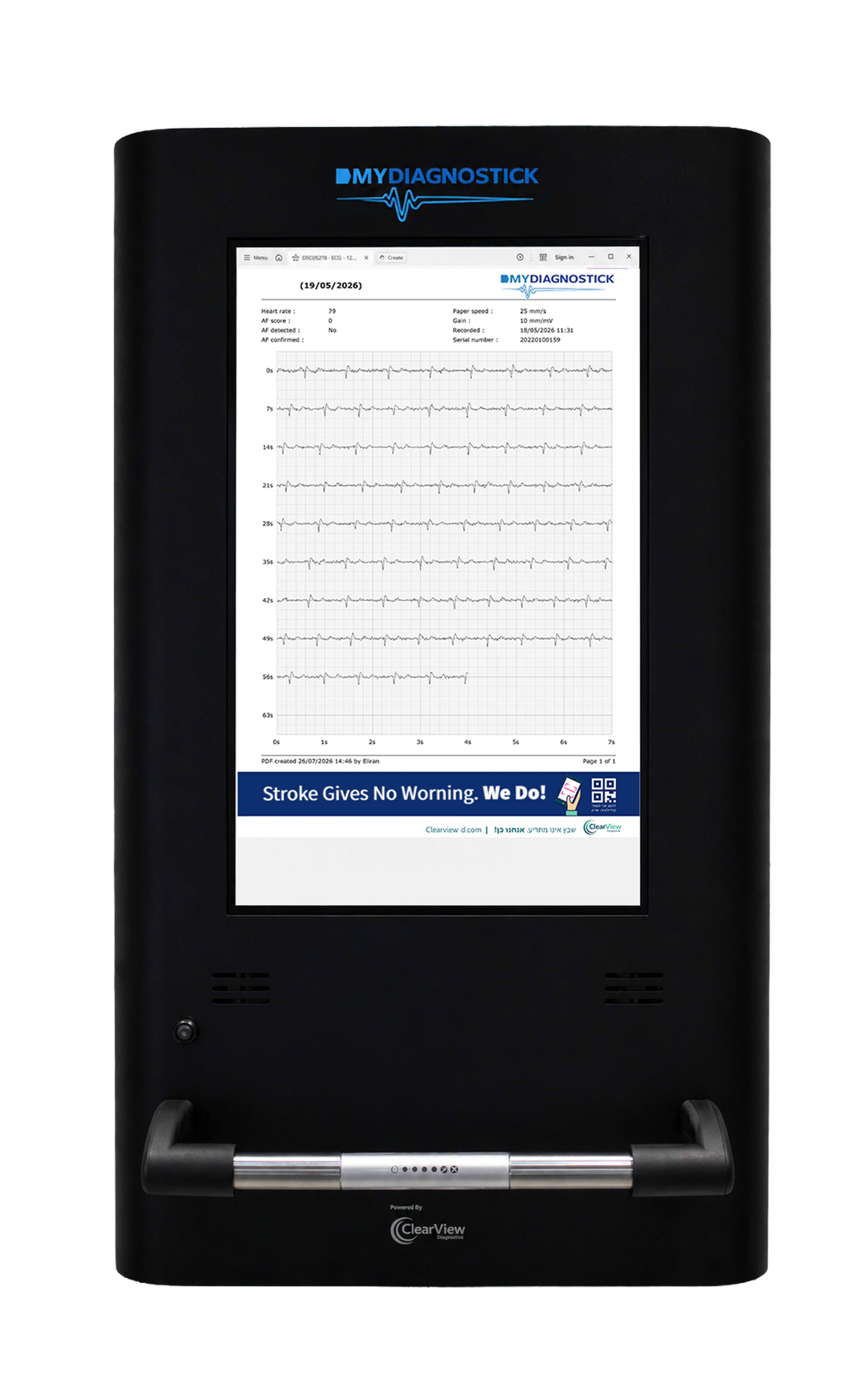 MY DIAGNOSTICKSCREENING
